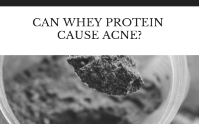 My personal Experience with Whey Protein and Acne