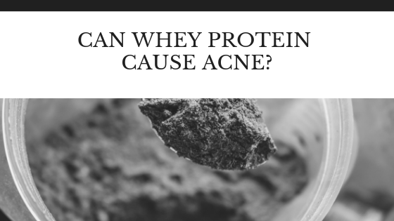 My personal Experience with Whey Protein and Acne